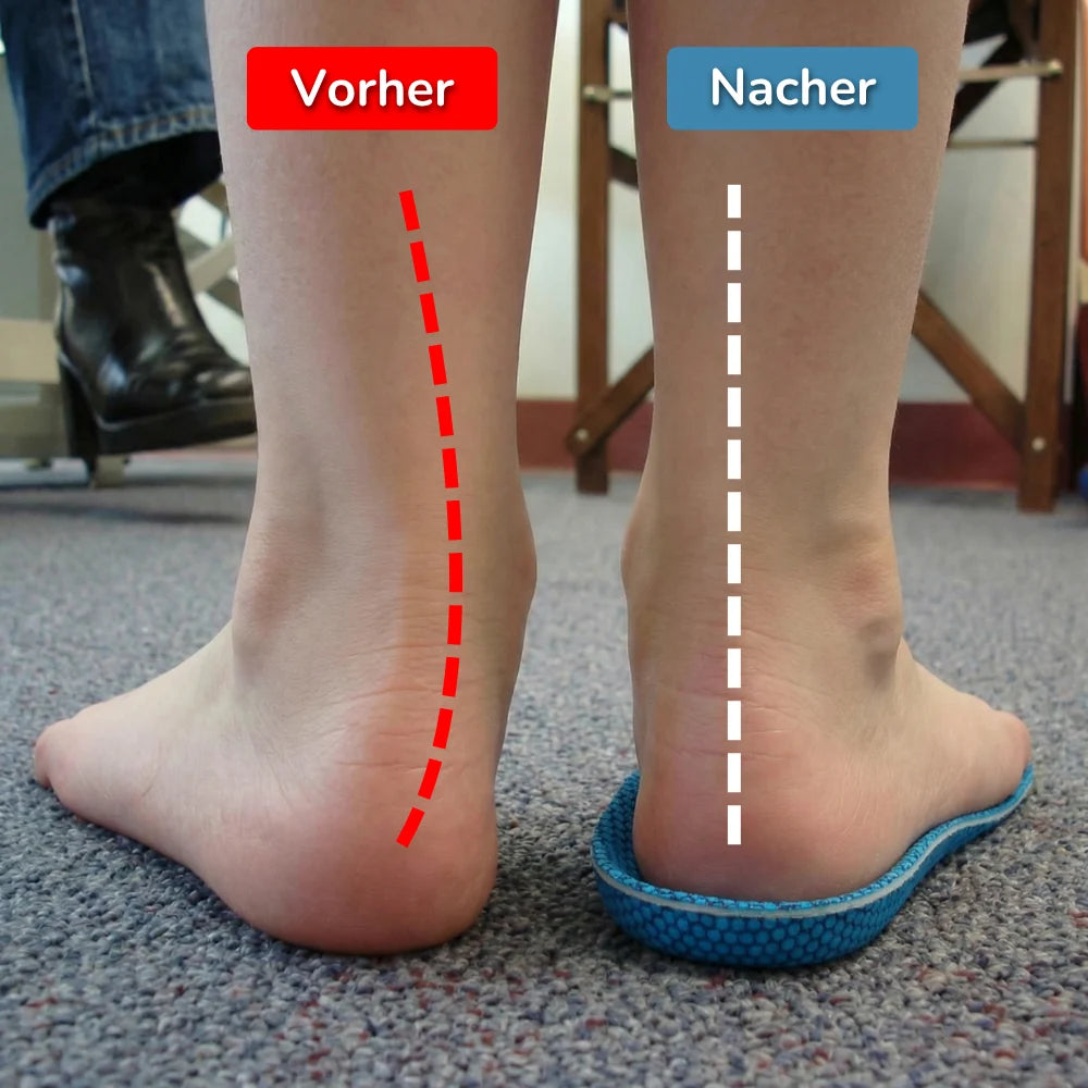 OrthoSole™
